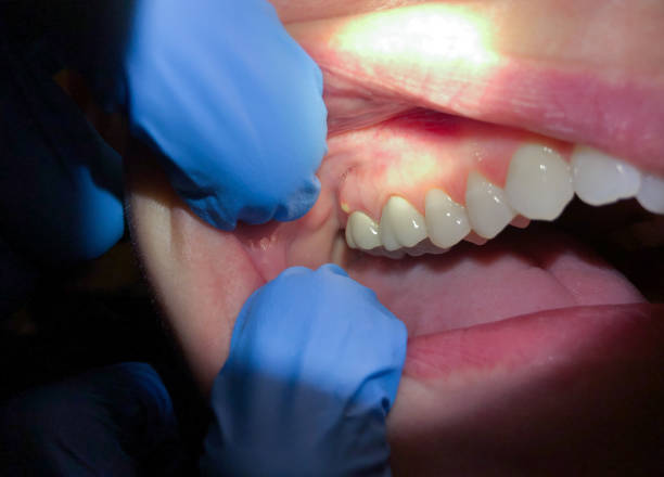 Best Weekend Emergency Dentist in Franklin Park, IL